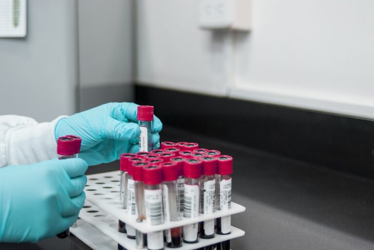 Dos manos con guantes desechables azules colocan tubos de ensayo con muestras de sangre en una gradilla que contiene más tubos.